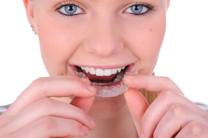 Face With Invisalign